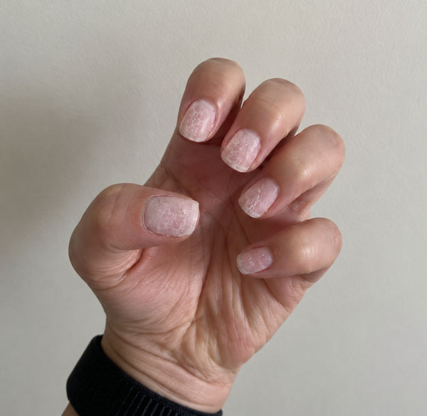 Before — Rachel K, 38