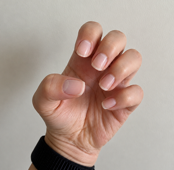 After — Rachel K, 38