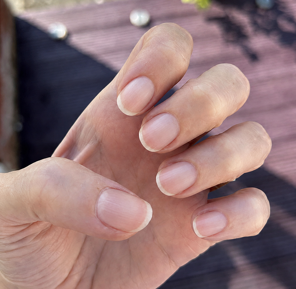 After — Sophie M, 29