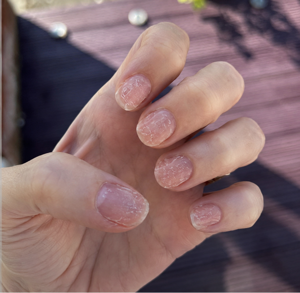 Before — Sophie M, 29