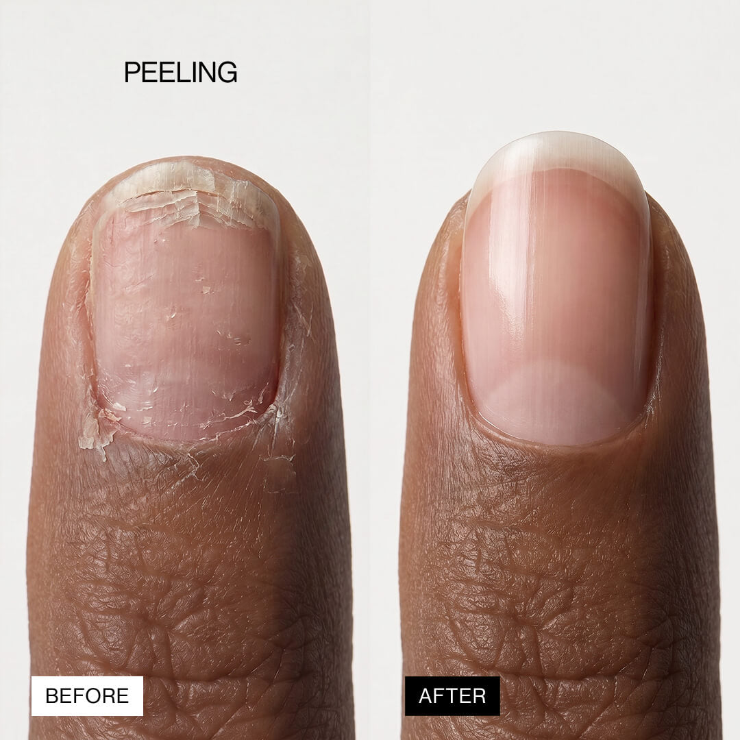 Lipifil-3 Complex™ Nail Serum