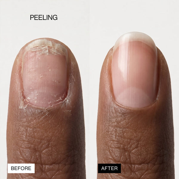 Lipifil-3 Complex™ Nail Serum