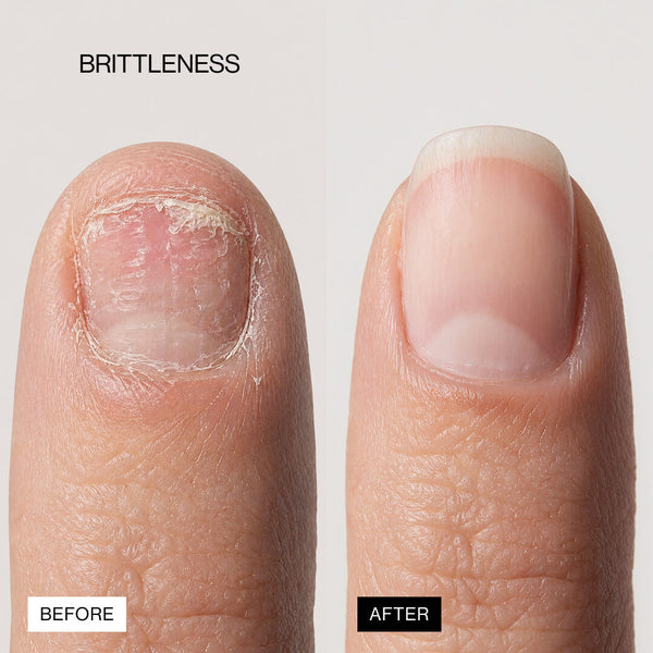 Lipifil-3 Complex™ Nail Serum