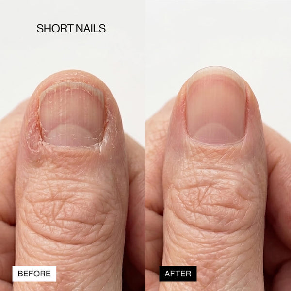 Lipifil-3 Complex™ Nail Serum
