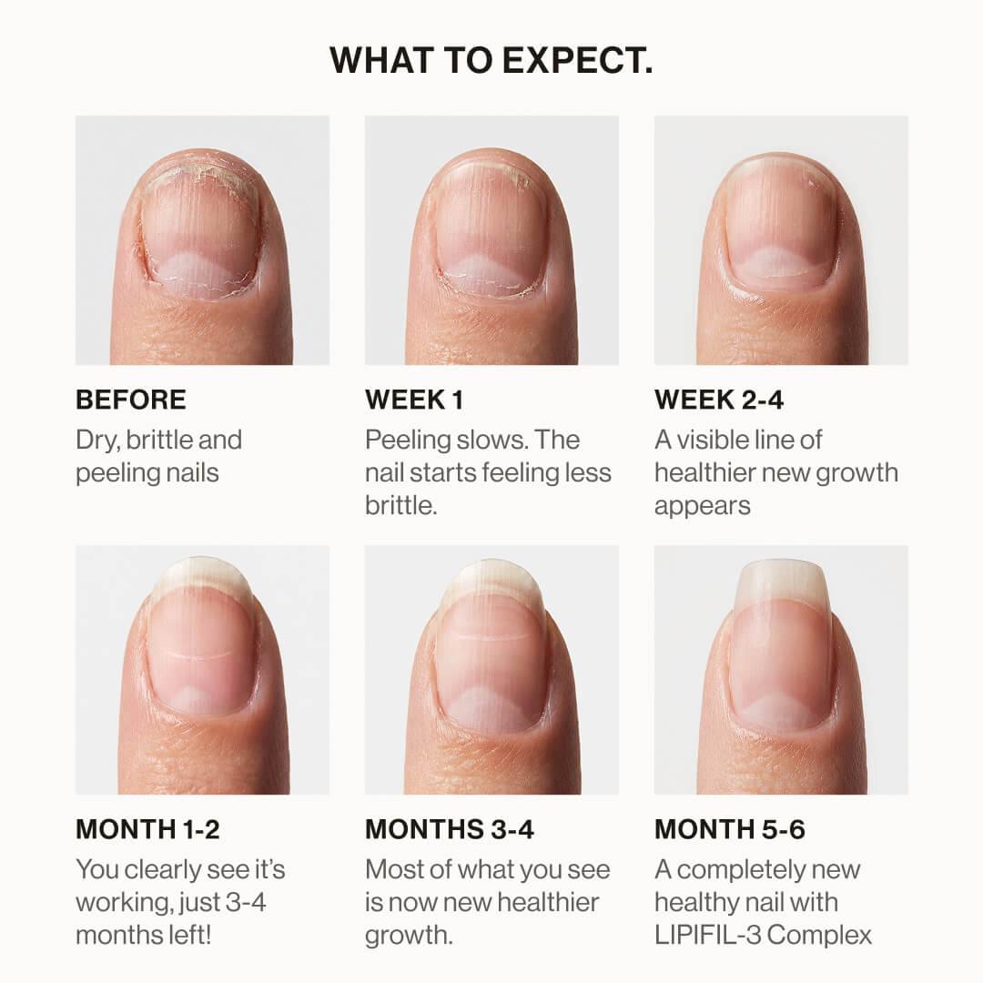 Lipifil-3 Complex™ Nail Serum