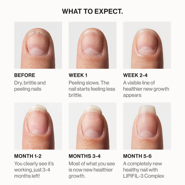 Lipifil-3 Complex™ Nail Serum