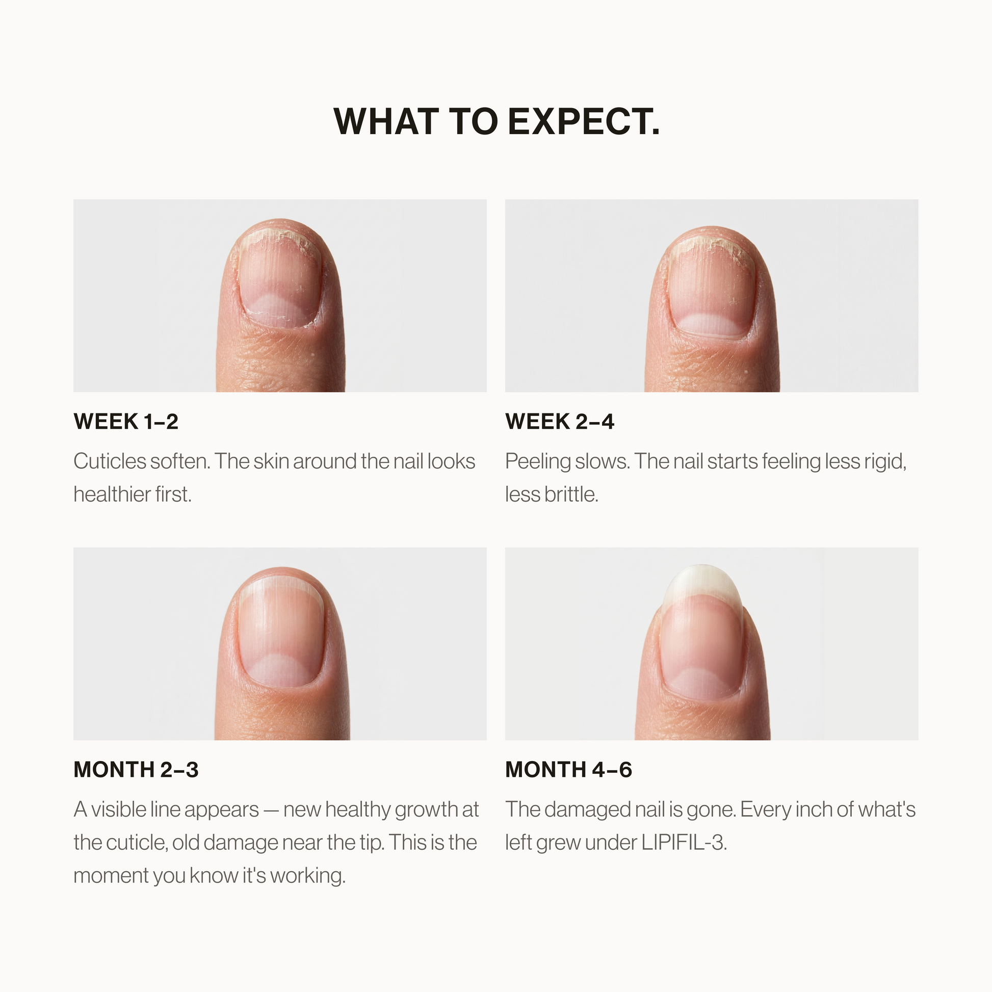 Lipifil-3 Complex™ - Nail Serum